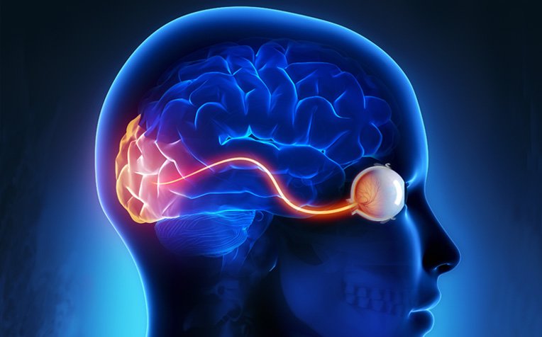 Optic Nerve Diagnostics