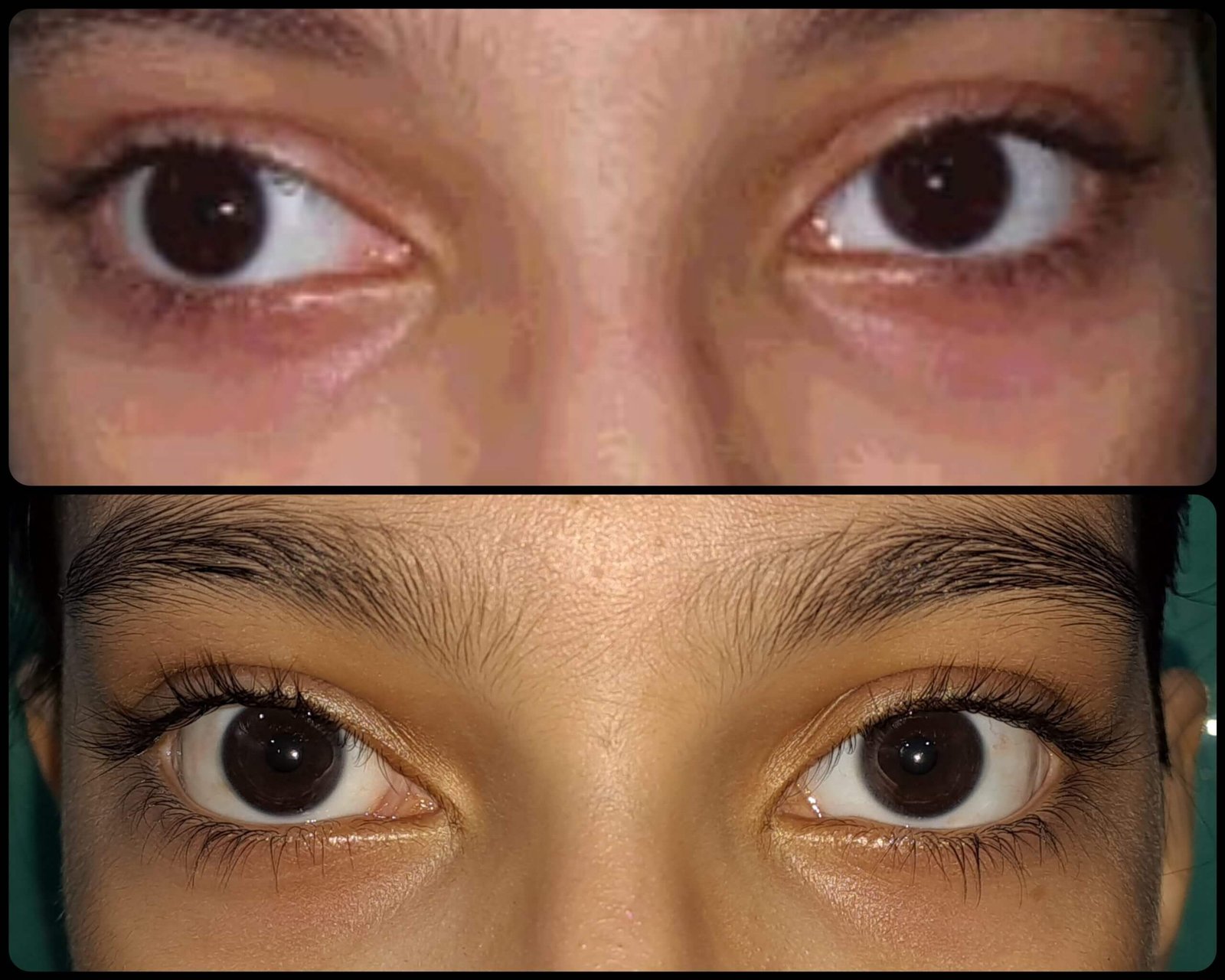 Orthoptic Evaluation